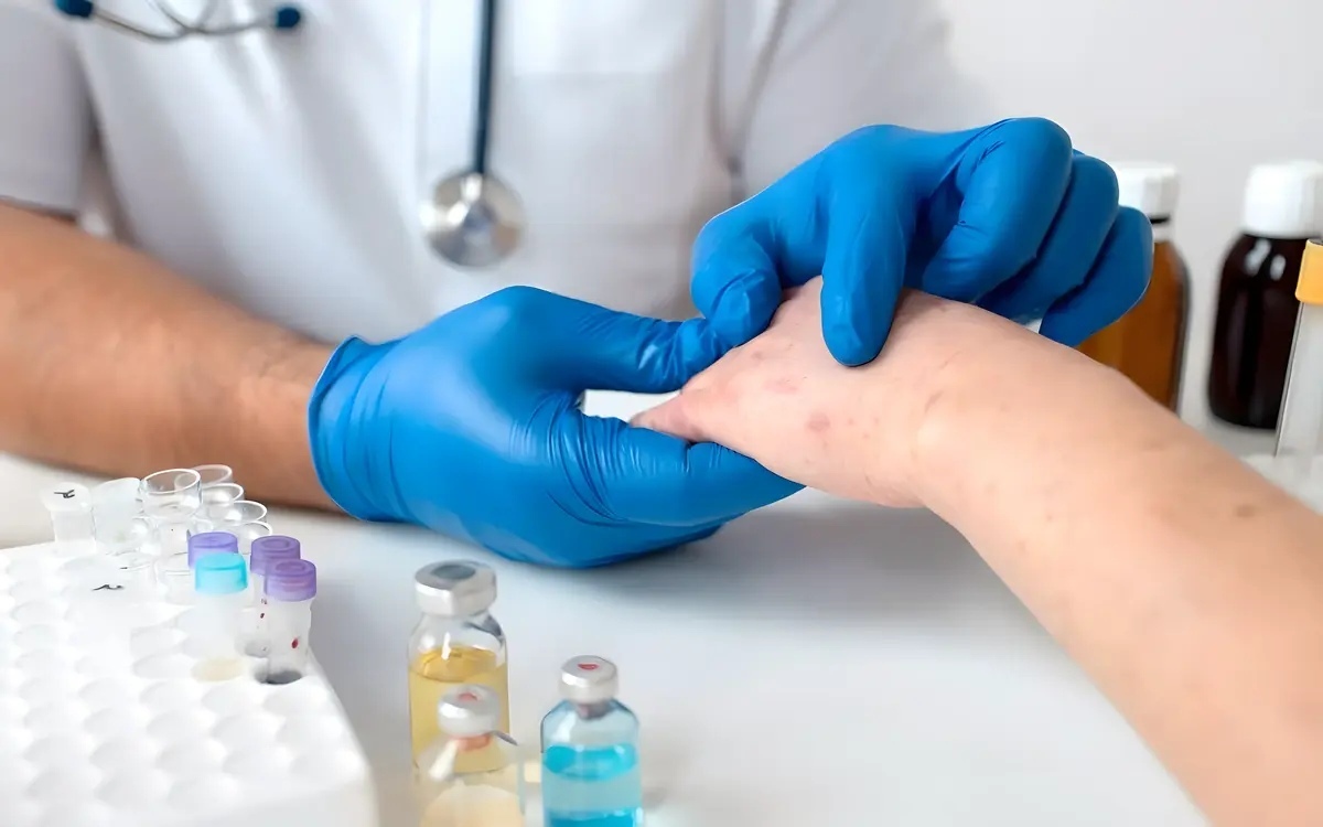 Erster mpox fall in lamphun hiv patient nach besuch von vergnuegungsbar infiziert