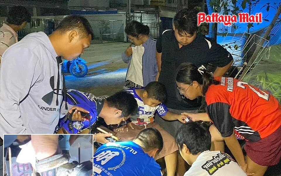 Fuss eines 10 jaehrigen jungen in pattaya von metallharke aufgespiesst