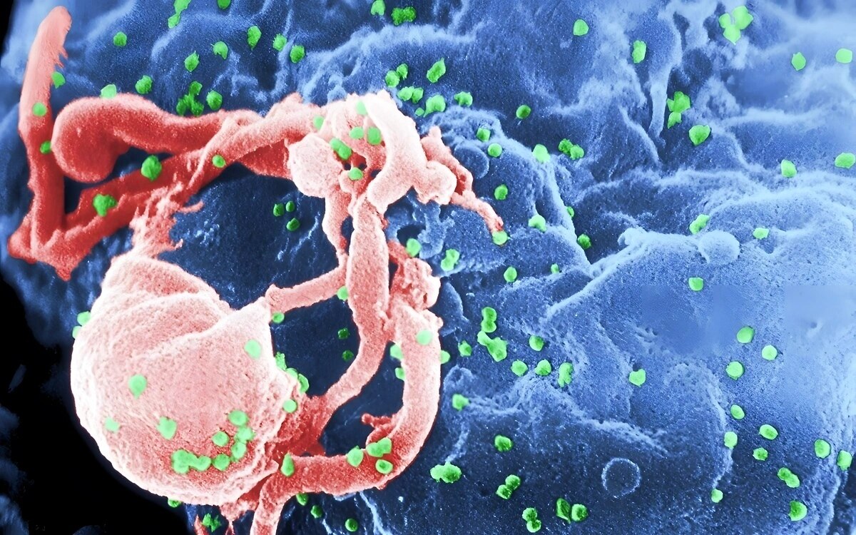 Berlin hiv neudiagnosen in deutschland steigen leicht an