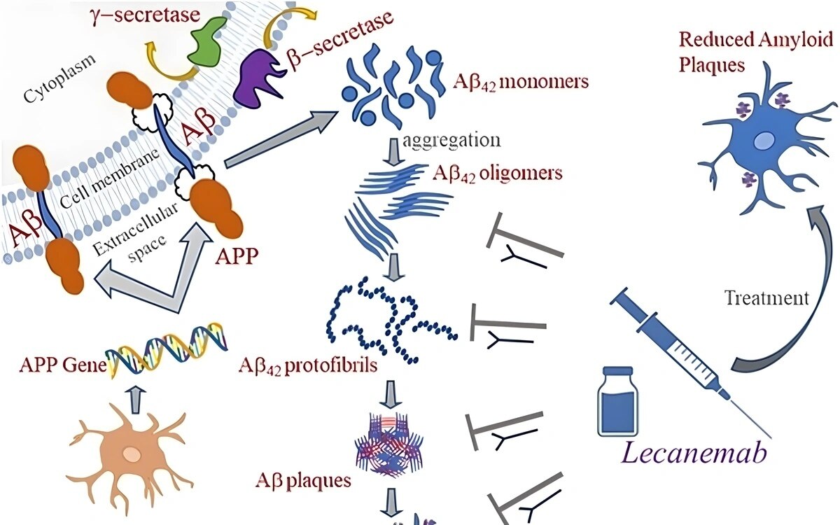 Berlin neuartige alzheimer therapie lecanemab steht vor eu zulassung